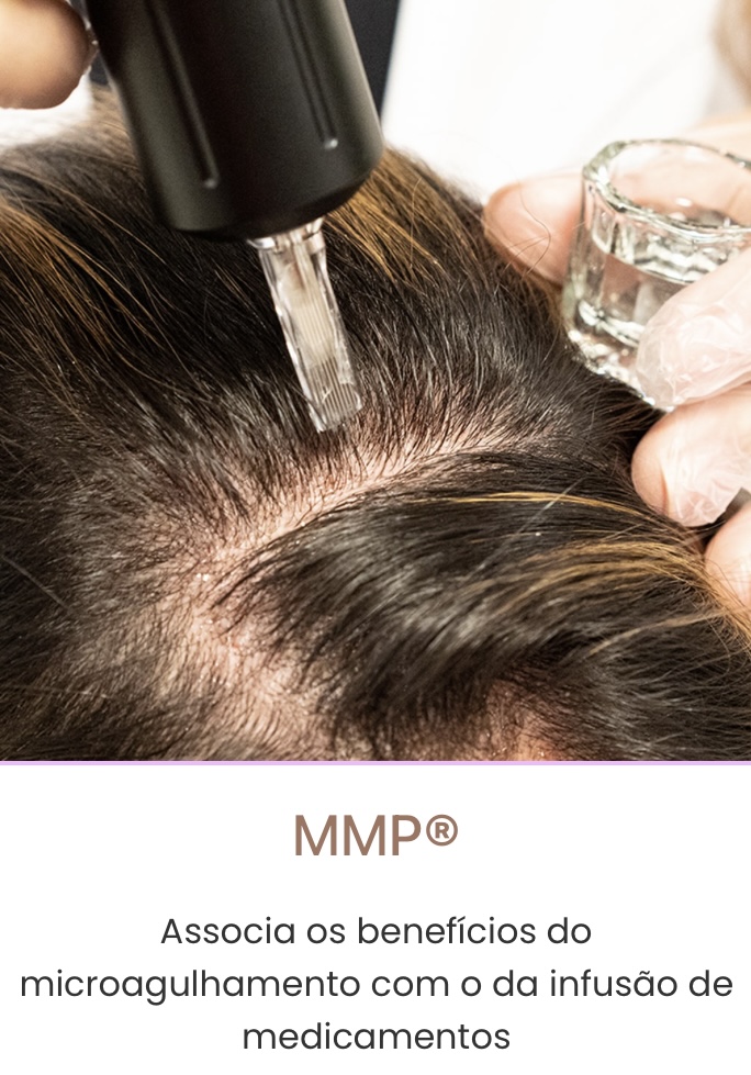 MMP microinfusao de medicamentos pela pele